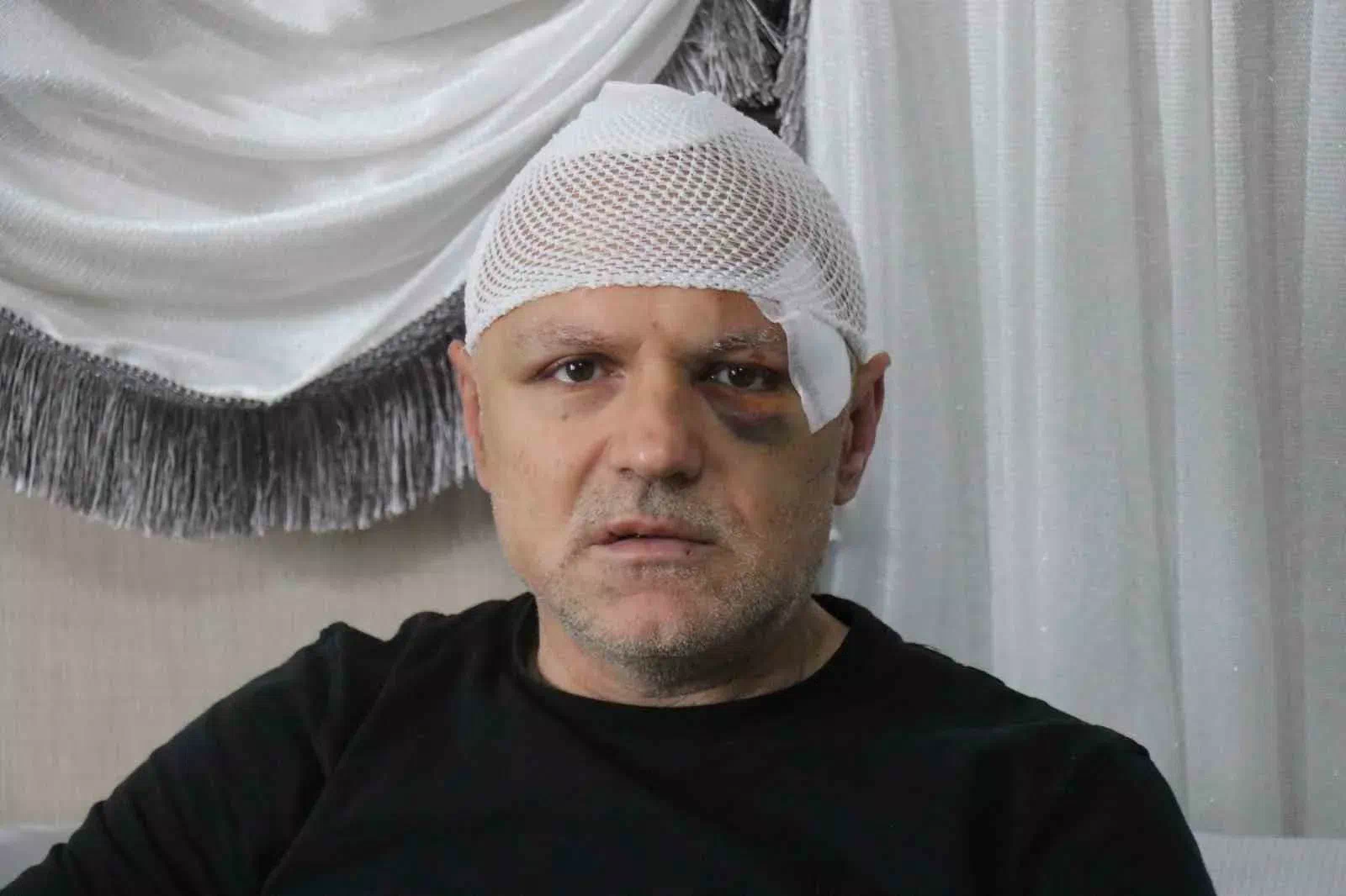 Adapazarı’nda Tekel Bayiinde Çıkan Kavga Sonucu İşletmeci Öldüresiye Darp Edildi