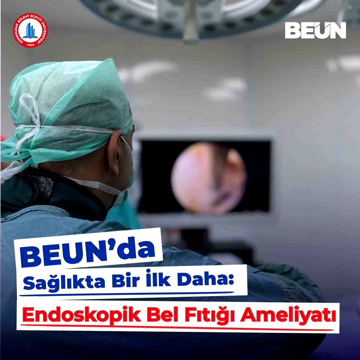 BEUN Hastanesi’nde endoskopik bel fıtığı ameliyatı başarıyla yapıldı