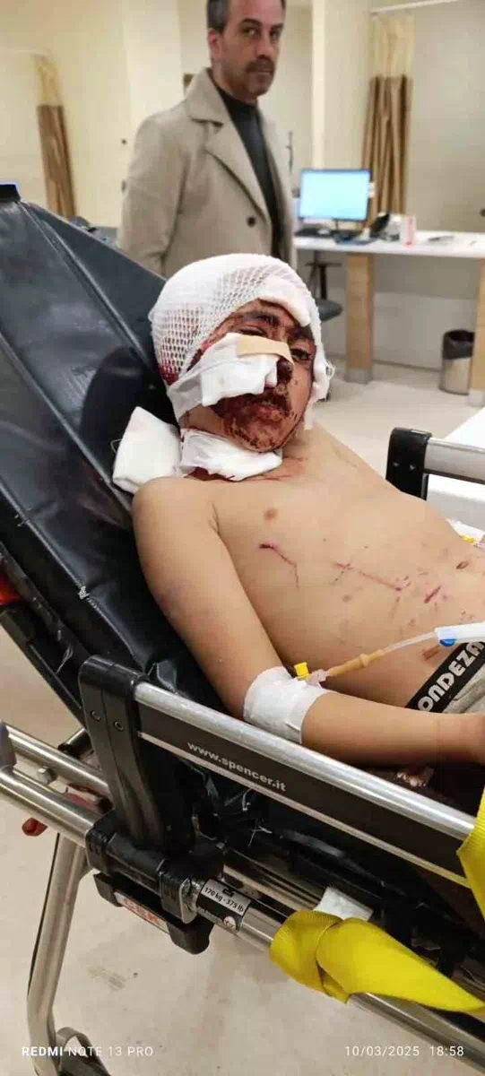Erzurum’da Başıboş Köpeklerin Saldırısına Uğrayan 10 Yaşındaki Çocuk Yoğun Bakımda