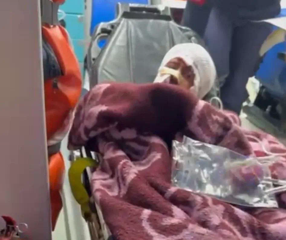 Erzurum’da köpek saldırısına uğrayan 10 yaşındaki çocuğun babası yetkilileri göreve çağırdı.