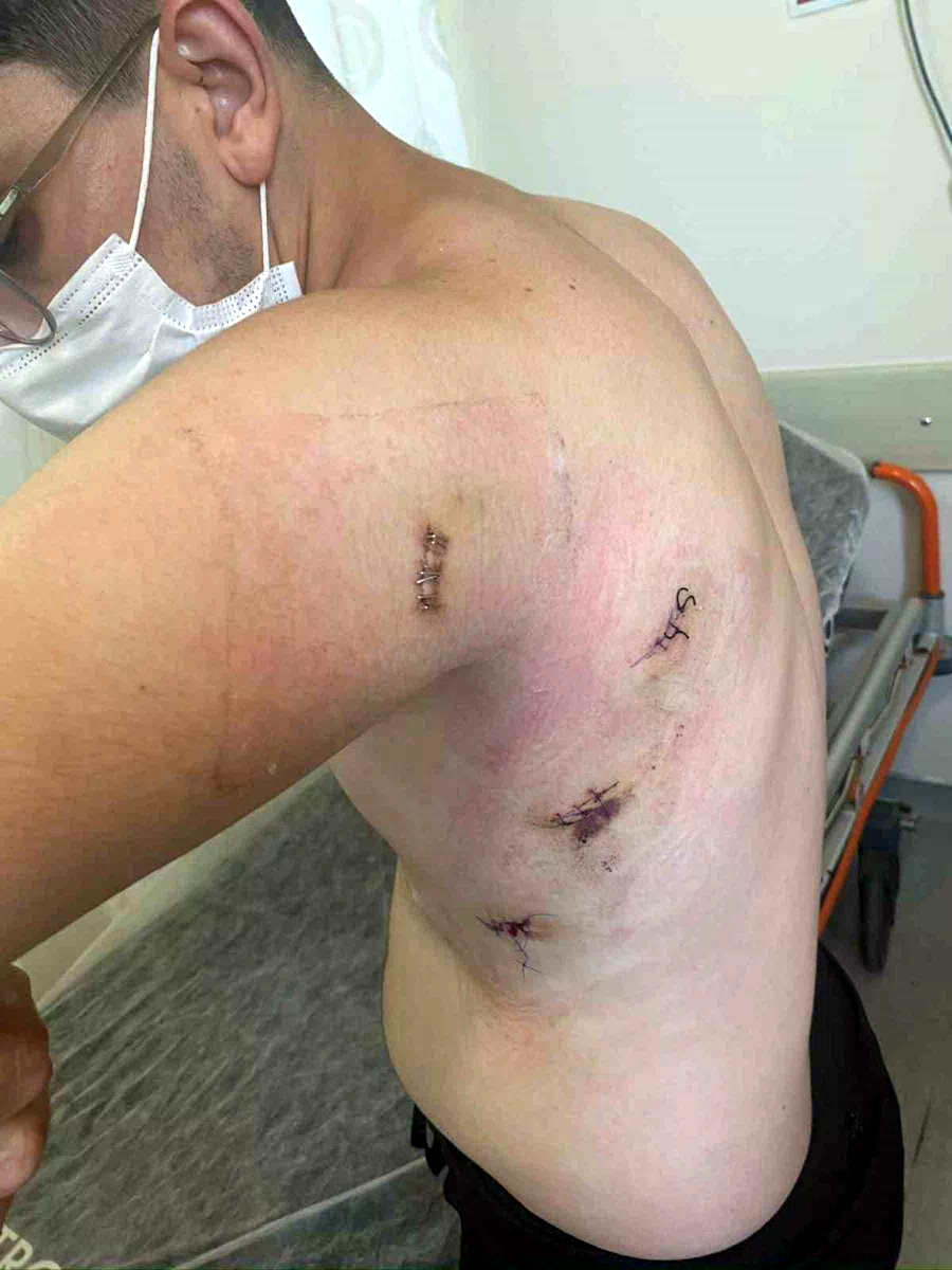 Kız kardeşini korumak isterken 5 yerinden bıçaklanmıştı: O anları anlattı: “Ölümden döndüm”