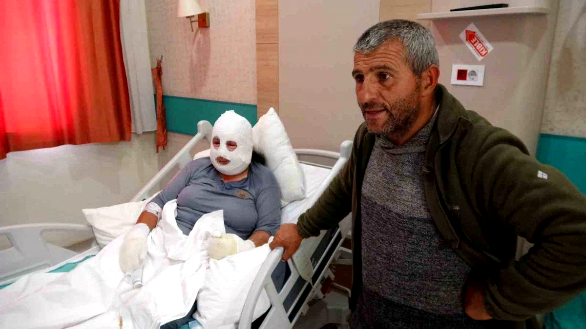Kızını kurtarmak için alevlerin arasına girdi, kendisi de yandı