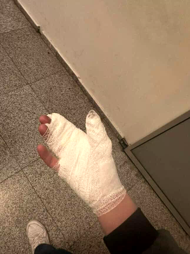 Kutlamalar meşale yanığıyla bitti