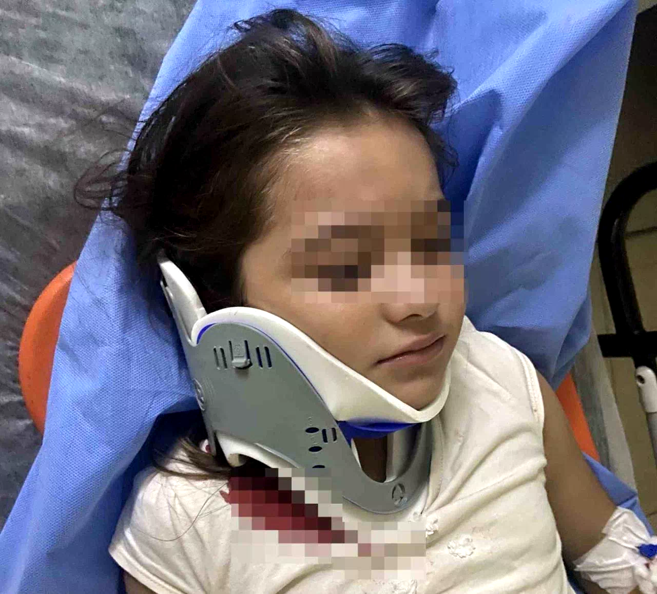 Ordu’da ters şeritten gelen scooter, 8 yaşındaki çocuğa çarptı