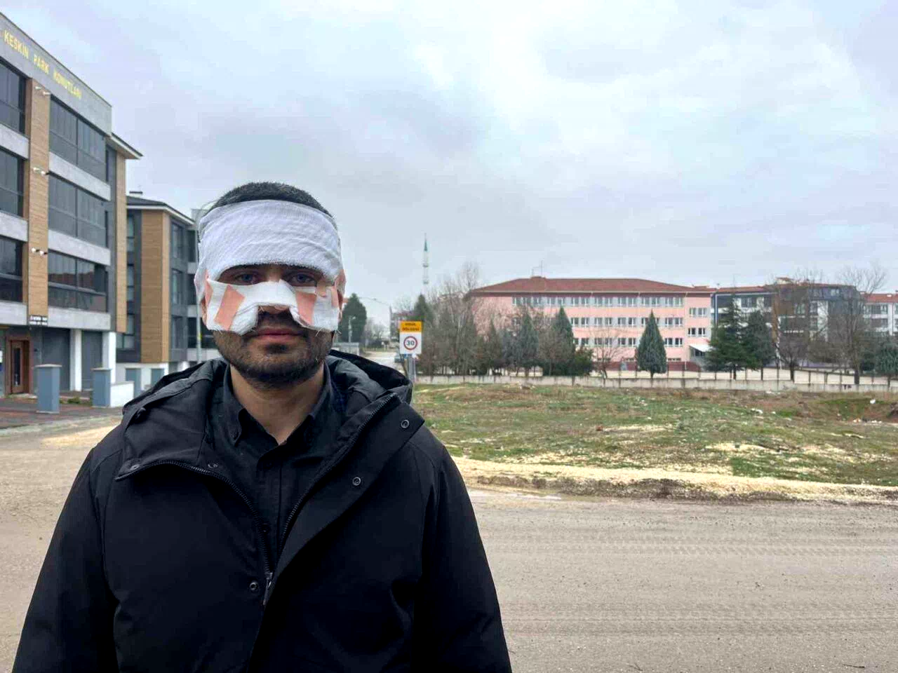 Rehber öğretmenin yüzüne sıcak çay fırlattığı fizik öğretmeni feci şekilde yandı