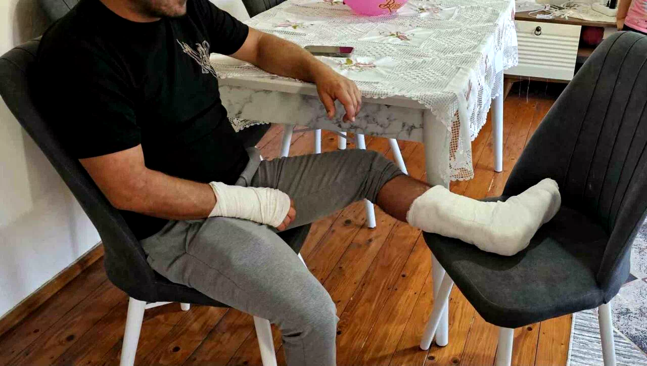 Sokak köpeğinin saldırısına uğradı, ayağı iki yerden kırıldı