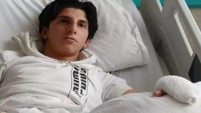 Bayburt’ta üniversite öğrencisi gencin parmağının incinmesi sonucu uyguladığı tedavi daha