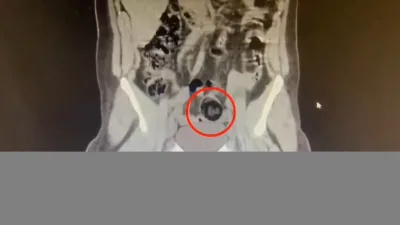 Kars’ta durdurulan yolcu otobüsündeki İranlı kuryenin makatından 105 gram metamfetamin