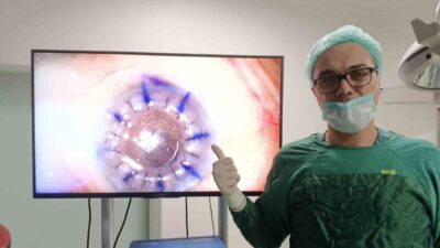 Samsun Eğitim ve Araştırma Hastanesi’nde ilk kez gerçekleştirilen kornea nakliyle,