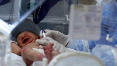 Türkiye’de canlı doğan bebek sayısı, geçen yıl 937 bin 559