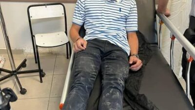 Kastamonu’nun Tosya ilçesinde başıboş köpeğin saldırısına uğrayan motosikletli kurye, boğazından