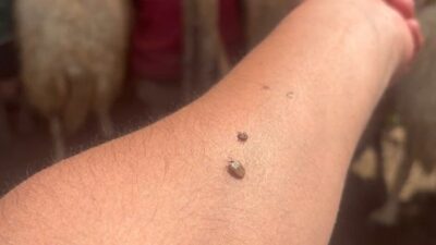 Erzincan İl Tarım ve Orman Müdürlüğü, yaz aylarında artış gösteren