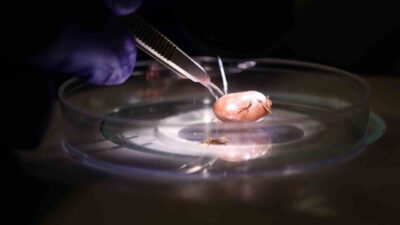 Prof. Dr. Kürşat Altay, ölümcül sonuçlar doğuran kenelerin hayvan vücutlarından