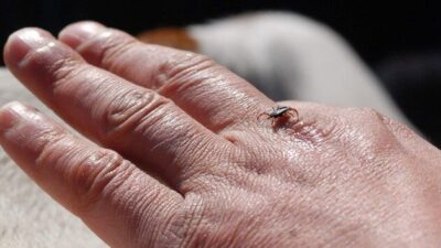 Erzurum Sağlık İl Müdürlüğü uzmanları; Kırım Kongo kanamalı ateşinin (KKKA),