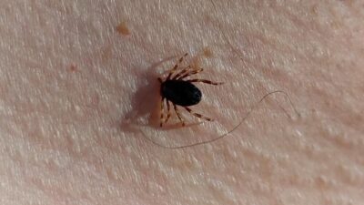 Karadeniz Teknik Üniversitesi (KTÜ) Farabi Hastanesi Enfeksiyon Hastalıkları ve Klinik