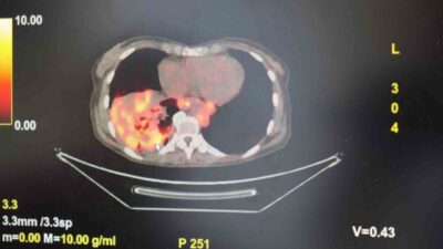 Göğüs Hastalıkları Uzmanı Prof. Dr. Şevket Özkaya, son yıllarda sigara