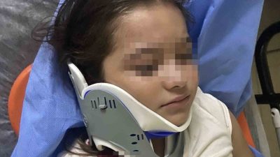 Ordu’nun Ünye ilçesinde ters yönden gelen scooter sürücüsü, 8 yaşındaki