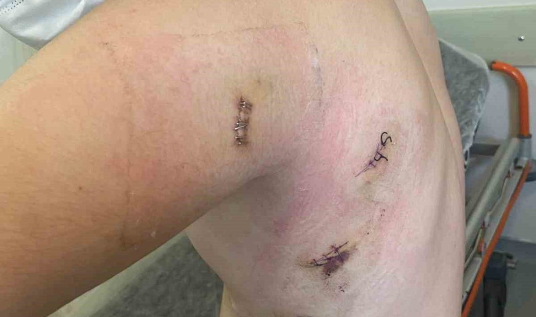 Sakarya’nın Ferizli ilçesinde kız kardeşini sözlü taciz ettiği ileri sürülen