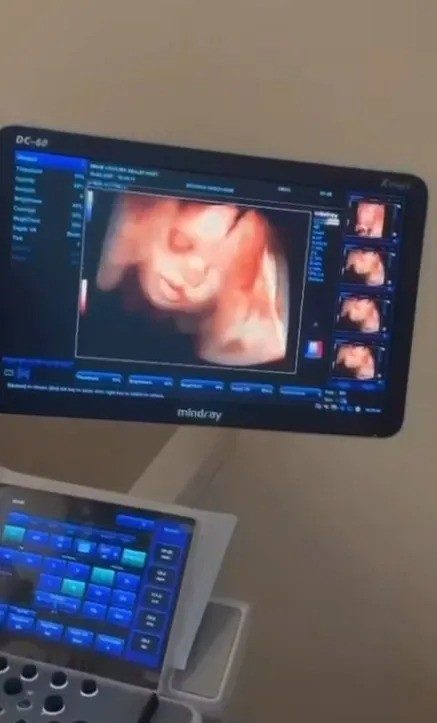 Sinop Atatürk Devlet Hastanesi Kadın Doğum Bölümü, anne adaylarına daha