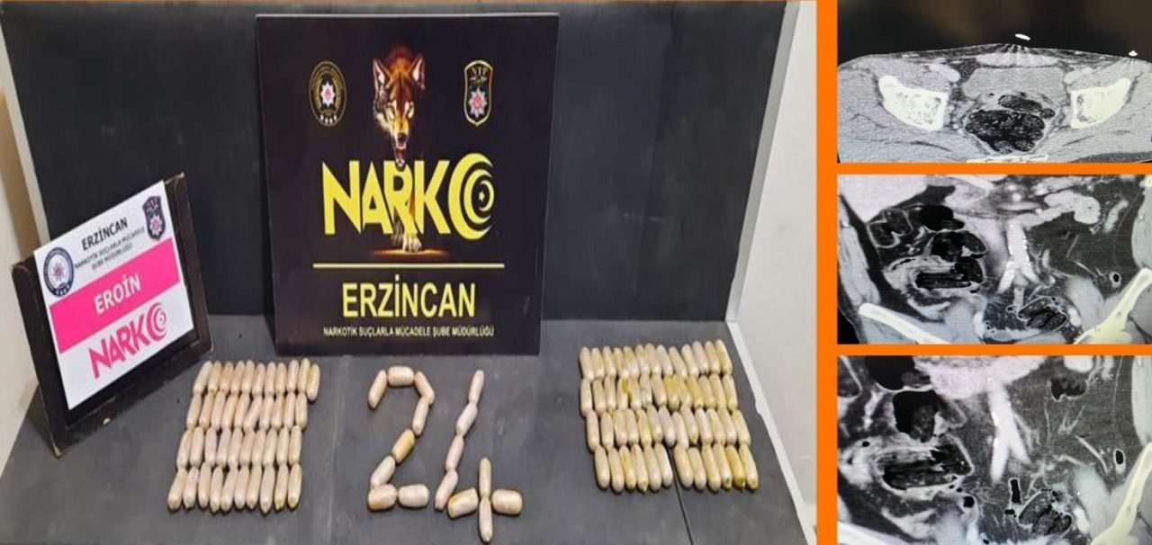 Erzincan’da gerçekleştirilen narkotik operasyonunda, midelerinde 109 kapsül uyuşturucu taşıyan iki