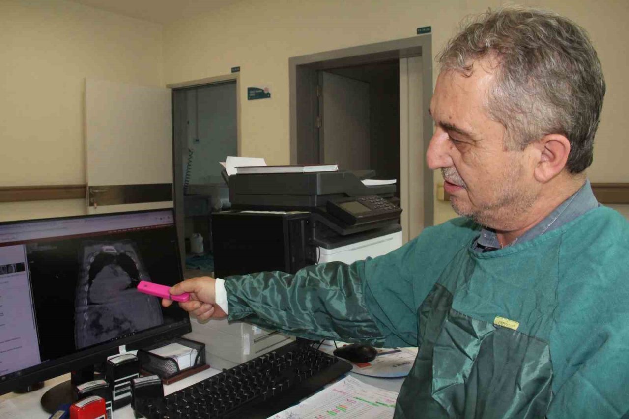 Giresun Eğitim ve Araştırma Hastanesinde demans hastalarının beslenmesinde geliştirilen yeni