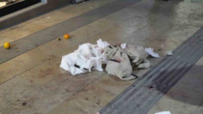 Gümüşhane’de boşanma aşamasındaki eşinin bıçaklı saldırısına uğrayan kadın yaralandı. Karaer