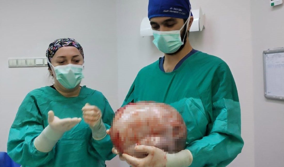 Amasya’da karnının 2 ayda 9 aylık hamile gibi büyümesi üzerine