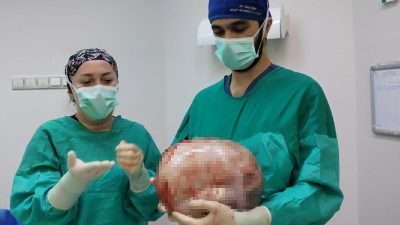 Amasya’da karnının 2 ayda 9 aylık hamile gibi büyümesi üzerine