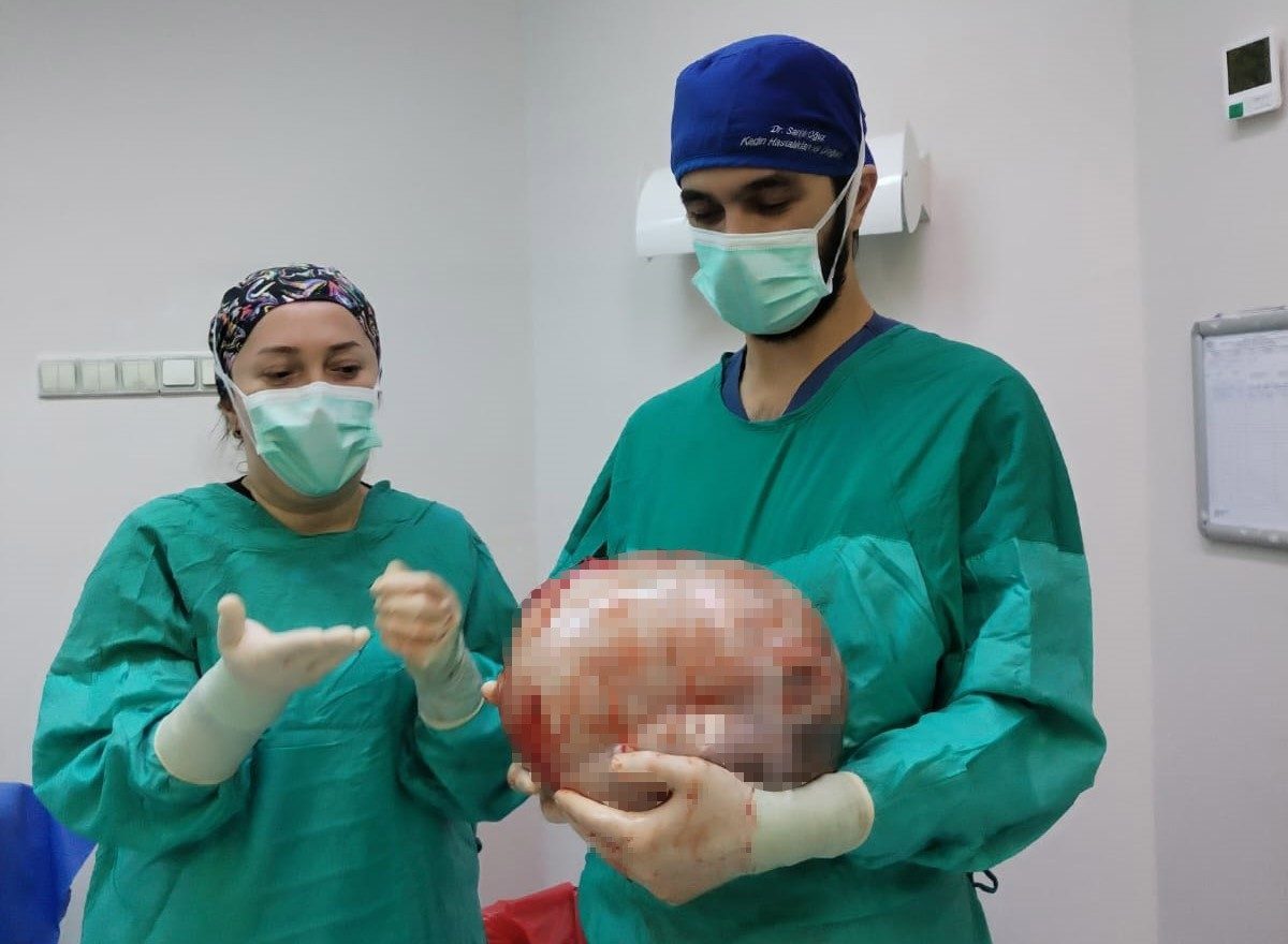 Amasya’da karnının 2 ayda 9 aylık hamile gibi büyümesi üzerine