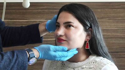 Hakkari’de ve çevre illerde 1,5 yıl boyunca tükürük bezindeki taş