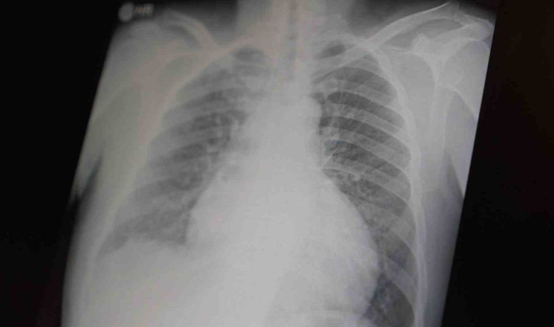 Göğüs Hastalıkları Uzm. Prof. Dr. Şevket Özkaya, tüm dünyada çocuk