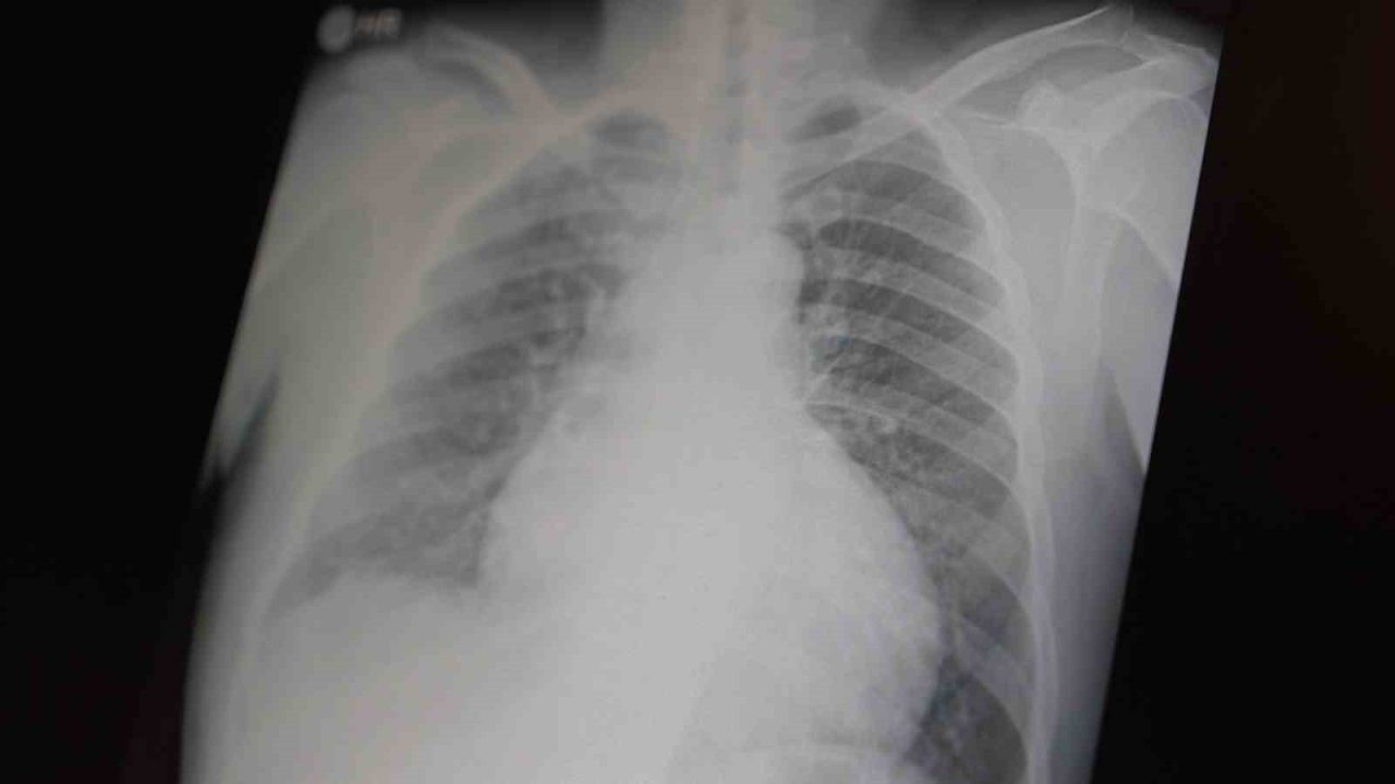 Göğüs Hastalıkları Uzm. Prof. Dr. Şevket Özkaya, tüm dünyada çocuk