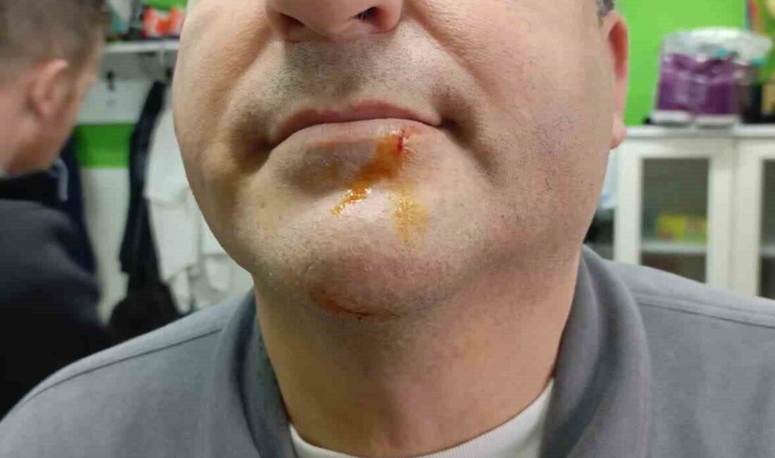 Zonguldak’ın Karadeniz Ereğli ilçesinde oynanan 3. lig maçının ardından çıkan